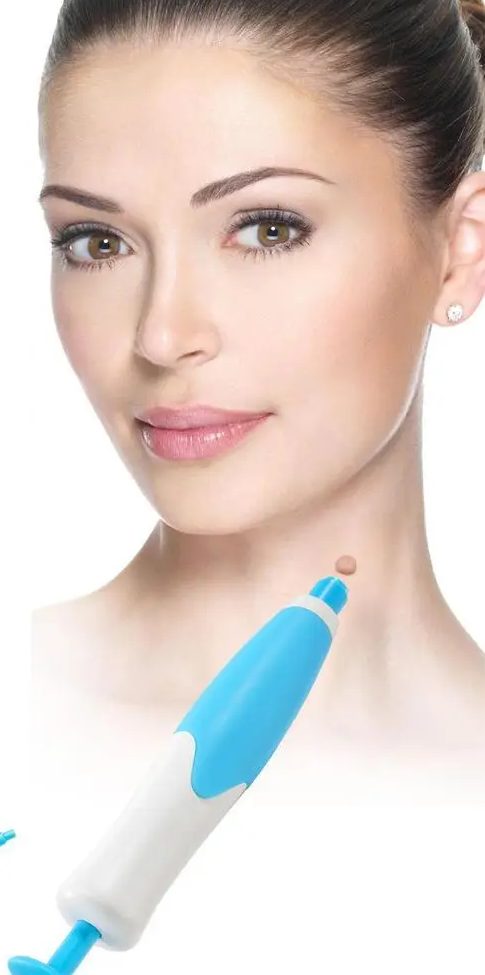 The applicator held against a skin tag on the side of the neck